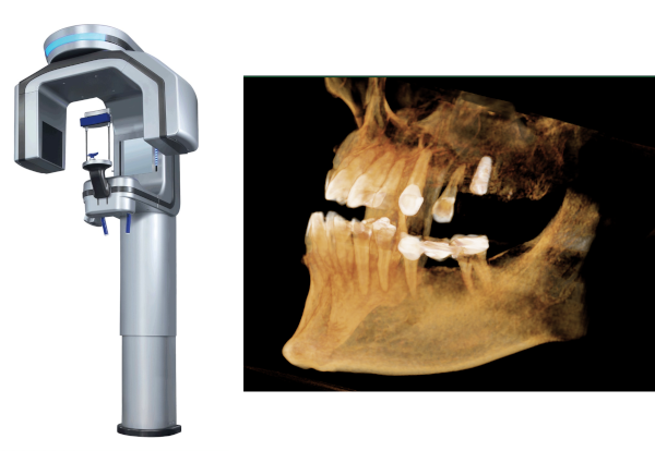 3D Full Mouth CBCT Imaging​